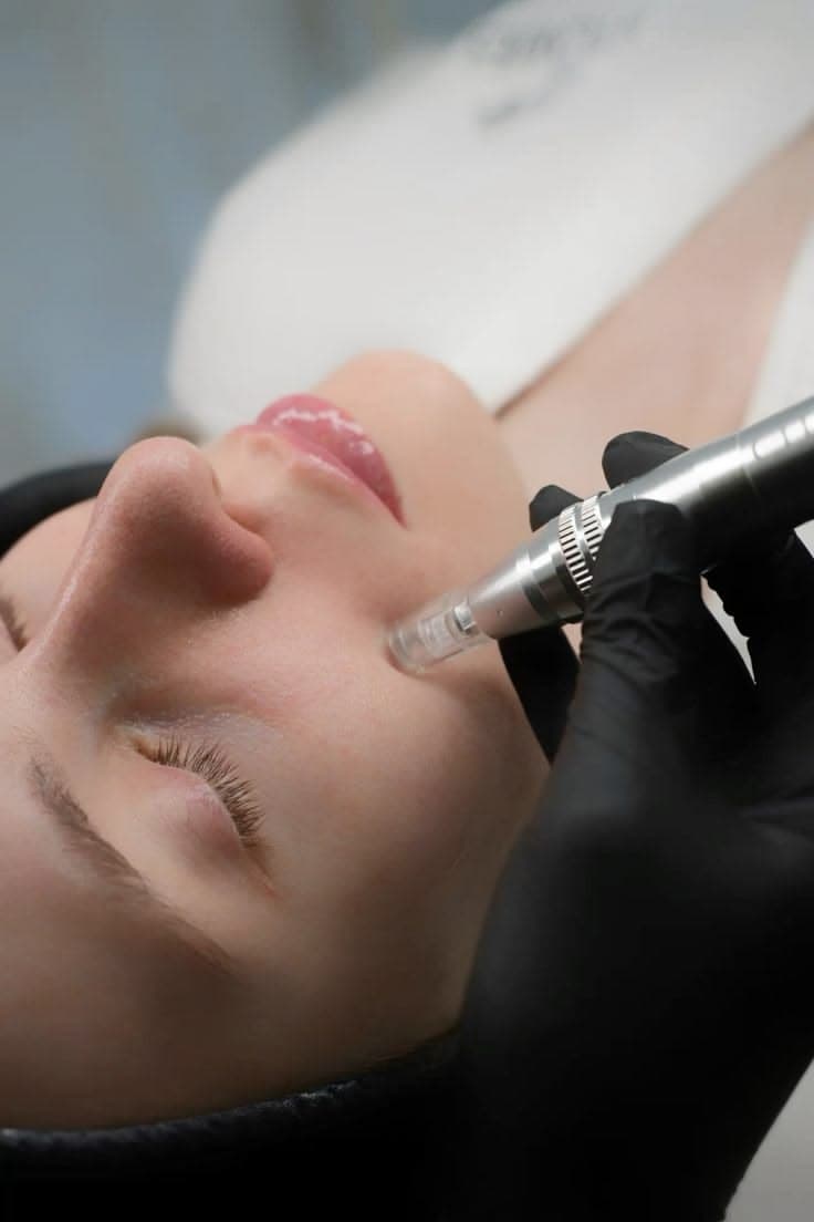 Terapia avanzada con Exosomas.