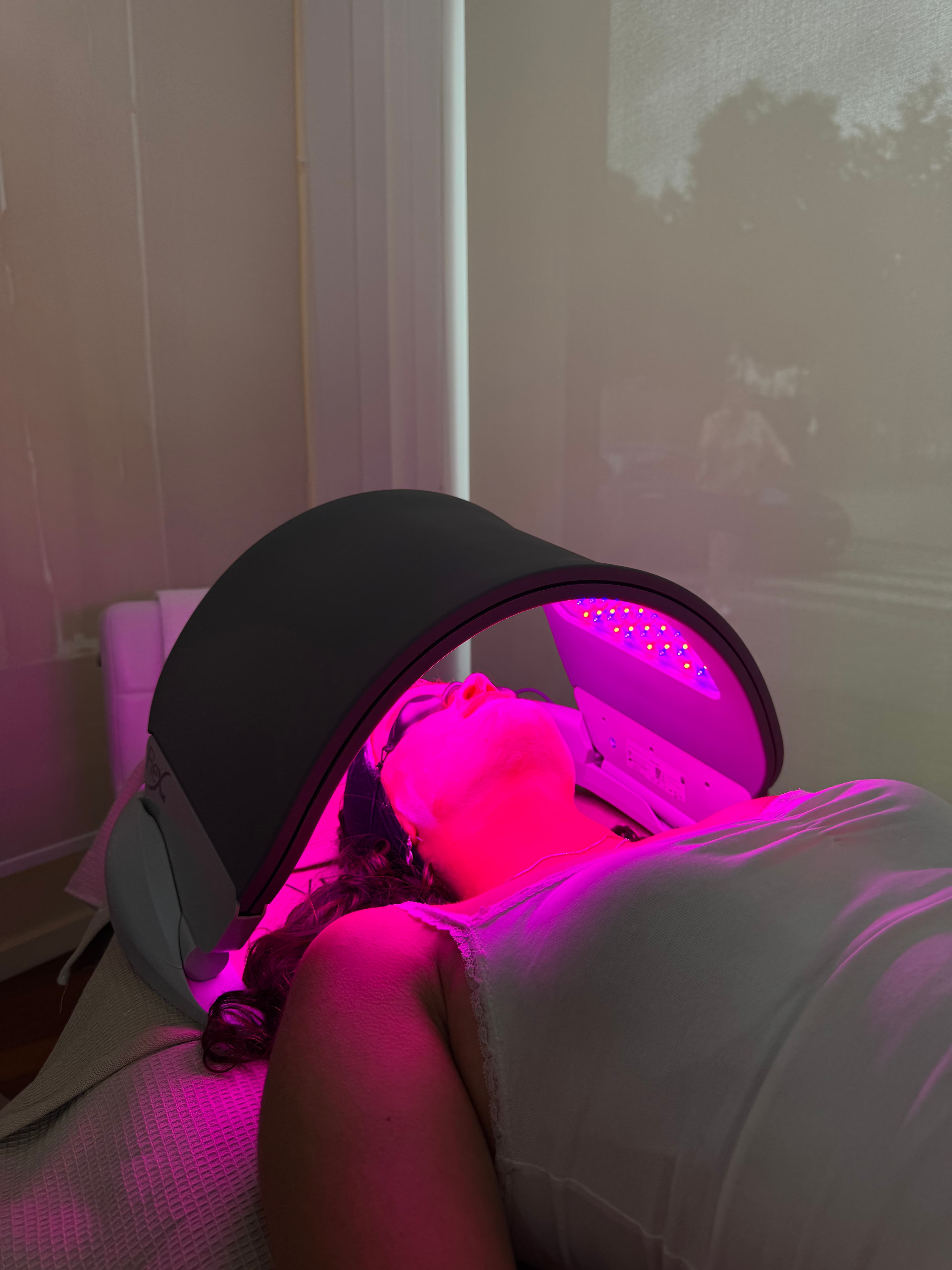 Terapia fotobiológica (Láser LED capilar)